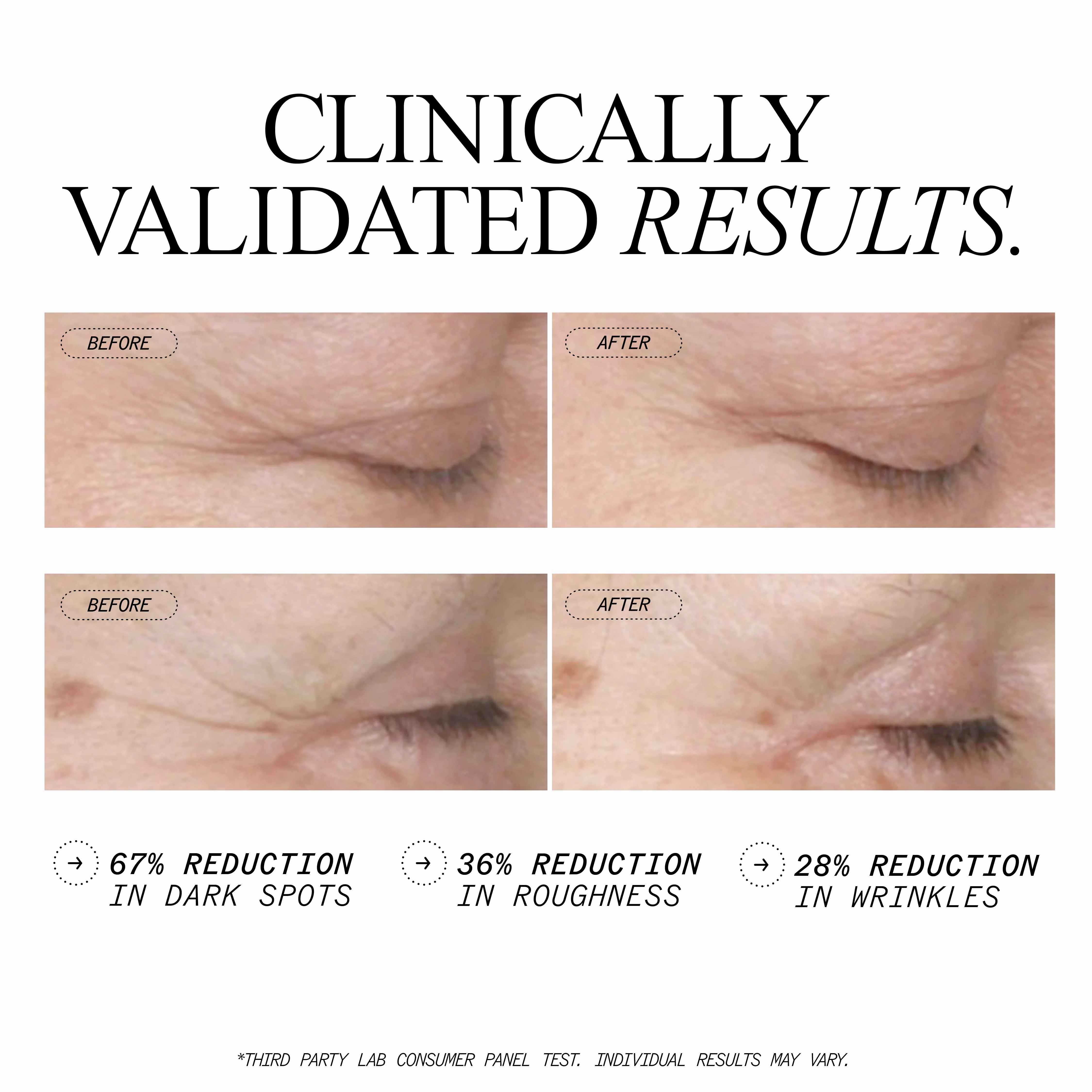 Anti-Wrinkle Retinol Overnight Serum Deluxe Size