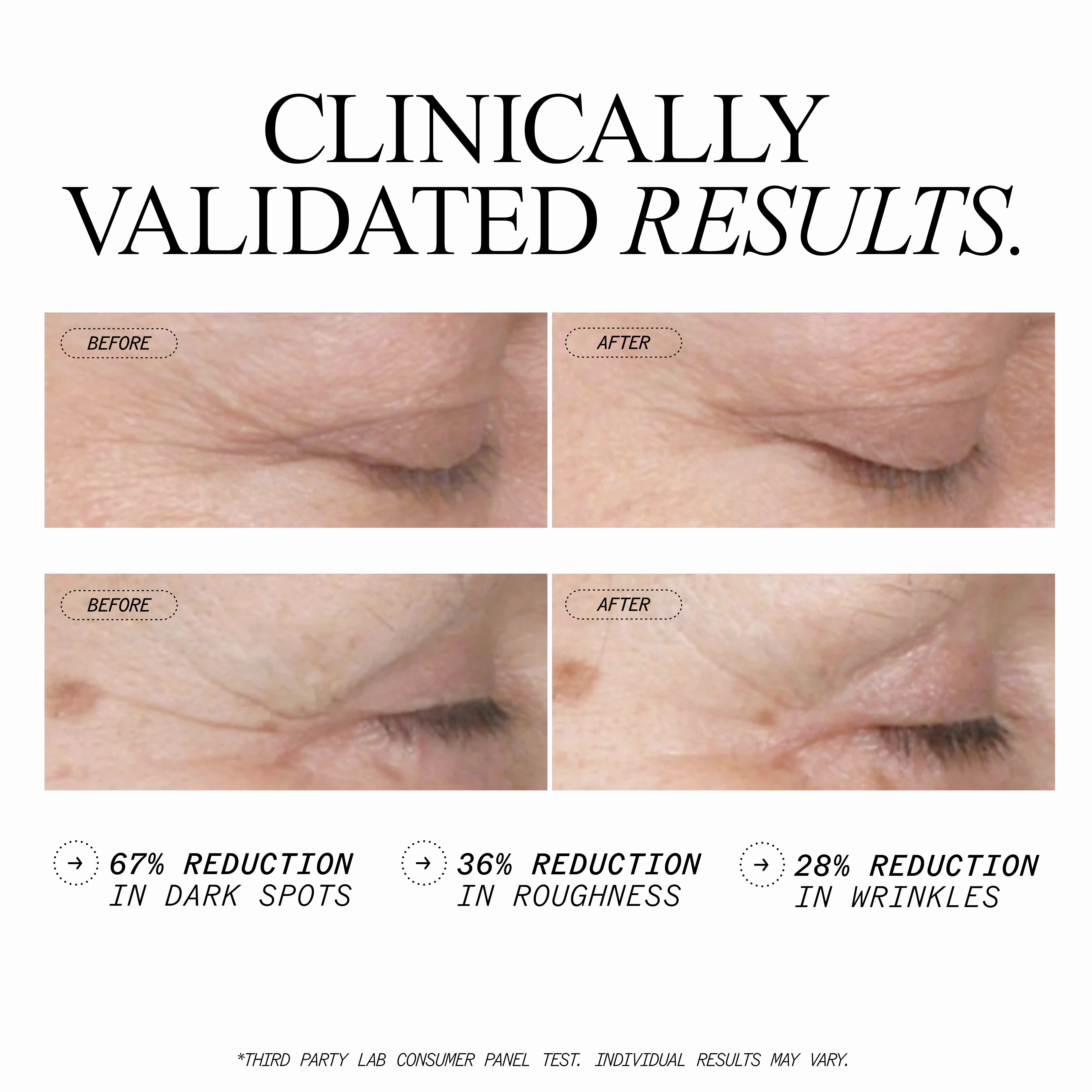 Anti-Wrinkle Retinol Overnight Serum