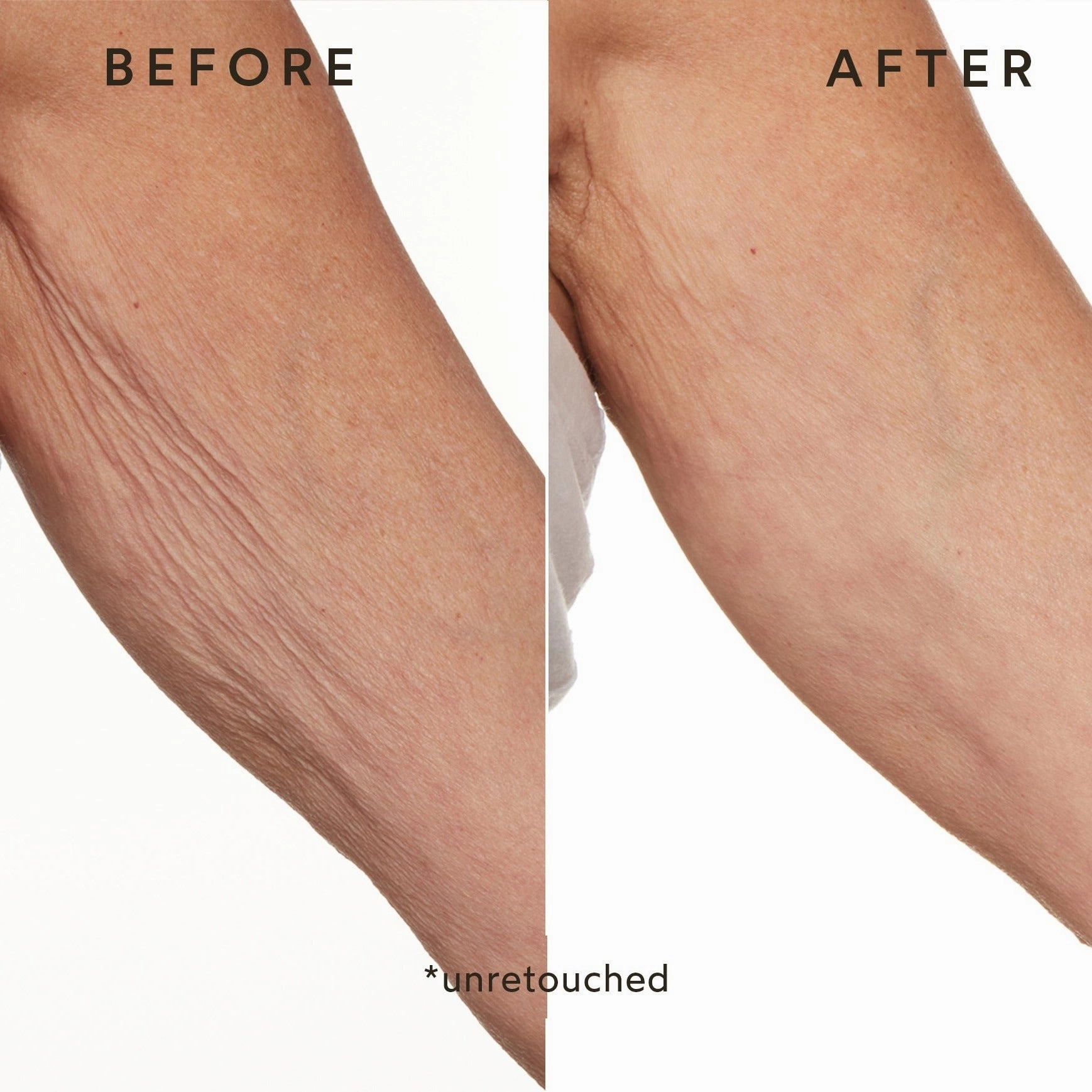 Phyto-Retinol Anti-Aging Body Lotion