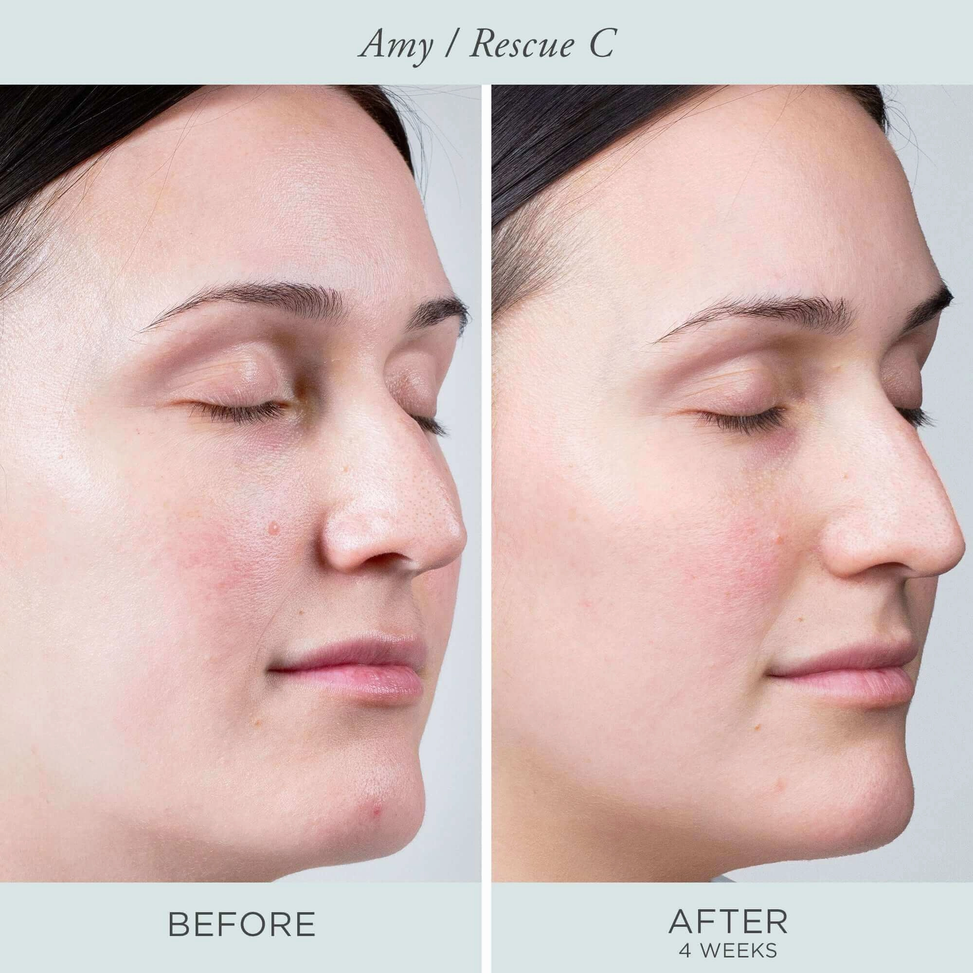 Rescue C Brightening Vitamin C & Peptide Eye Cream