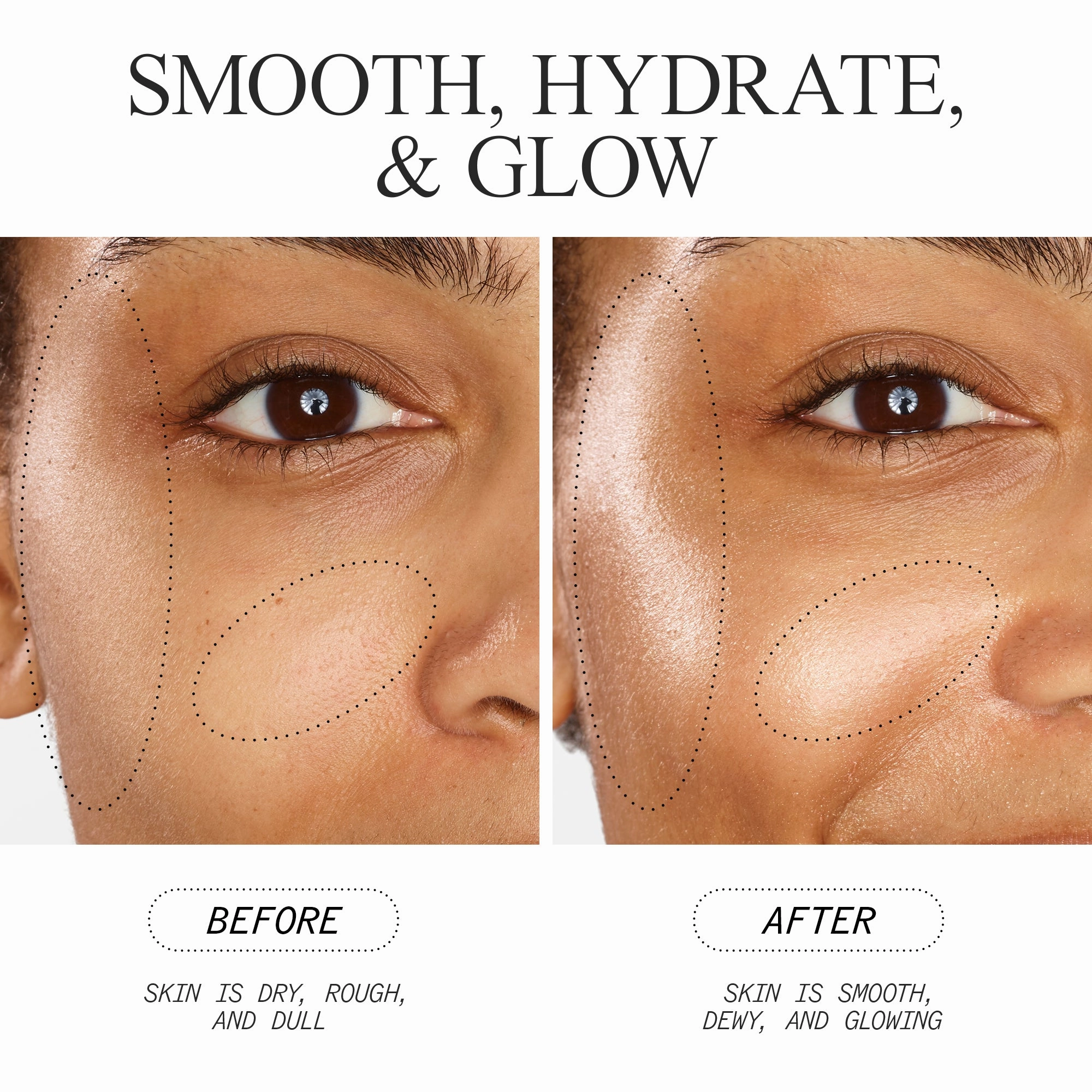 Skin Biome Hydration & Repair