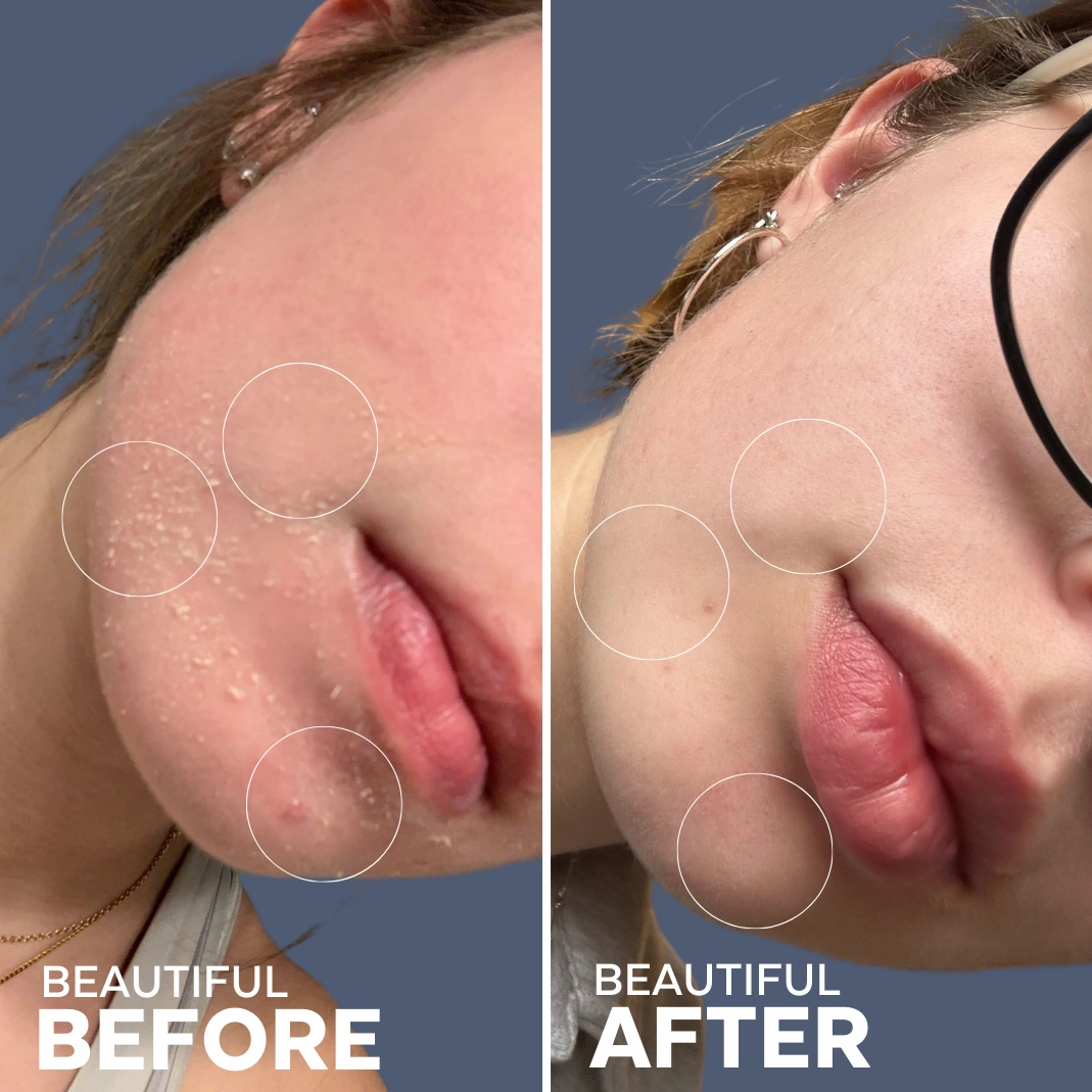 Skin Hero Bakuchiol   Calendula Serum