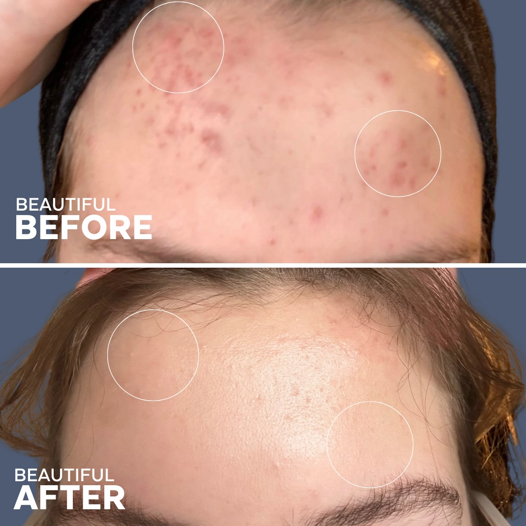 Skin Hero Bakuchiol   Calendula Serum
