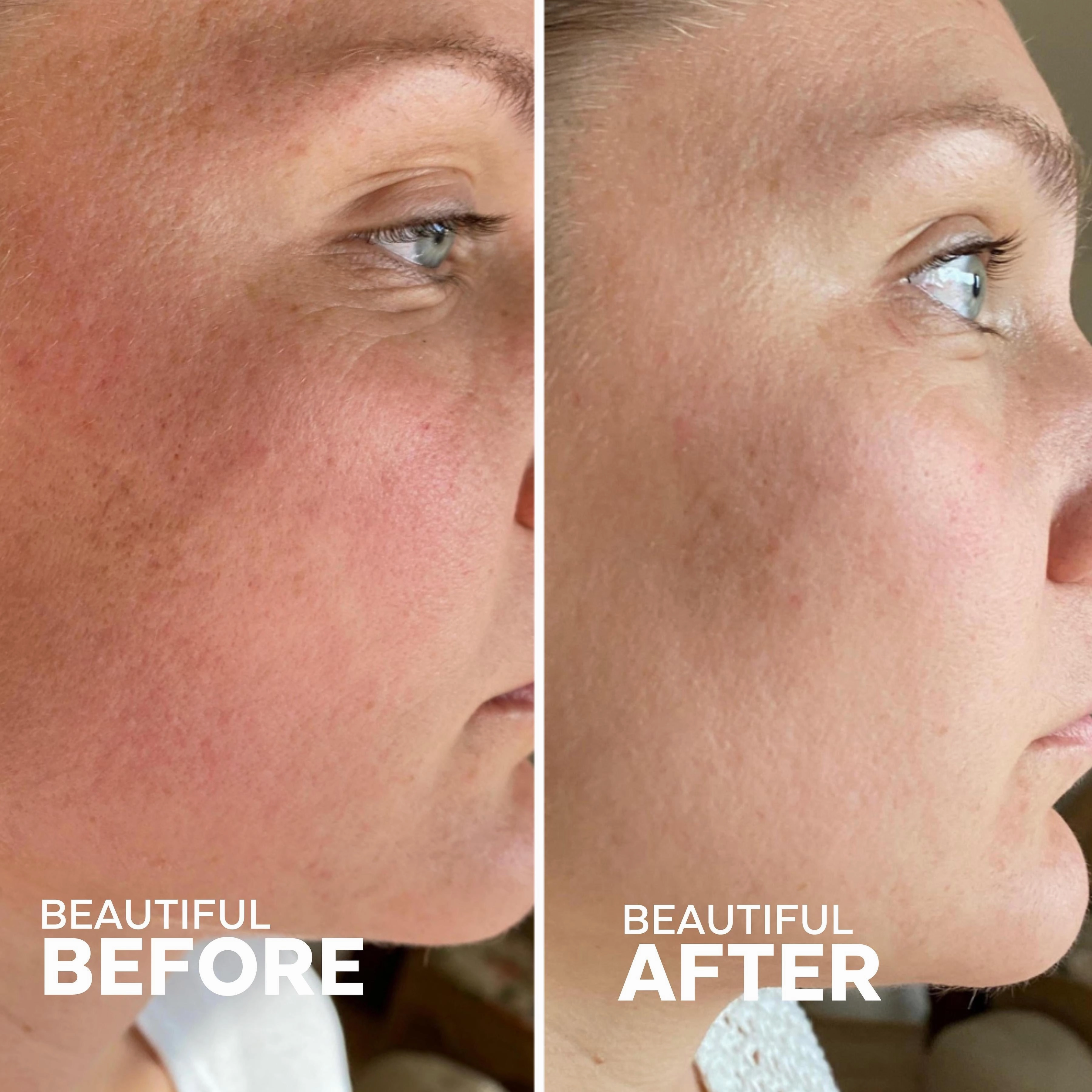 Skin Hero Bakuchiol   Calendula Serum